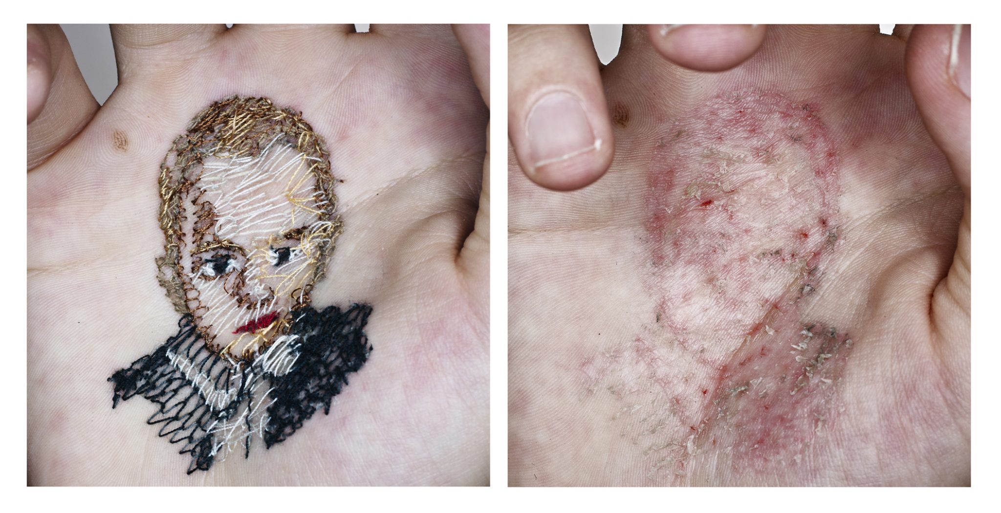 Mi hermano Javi. A flor de piel, 01.