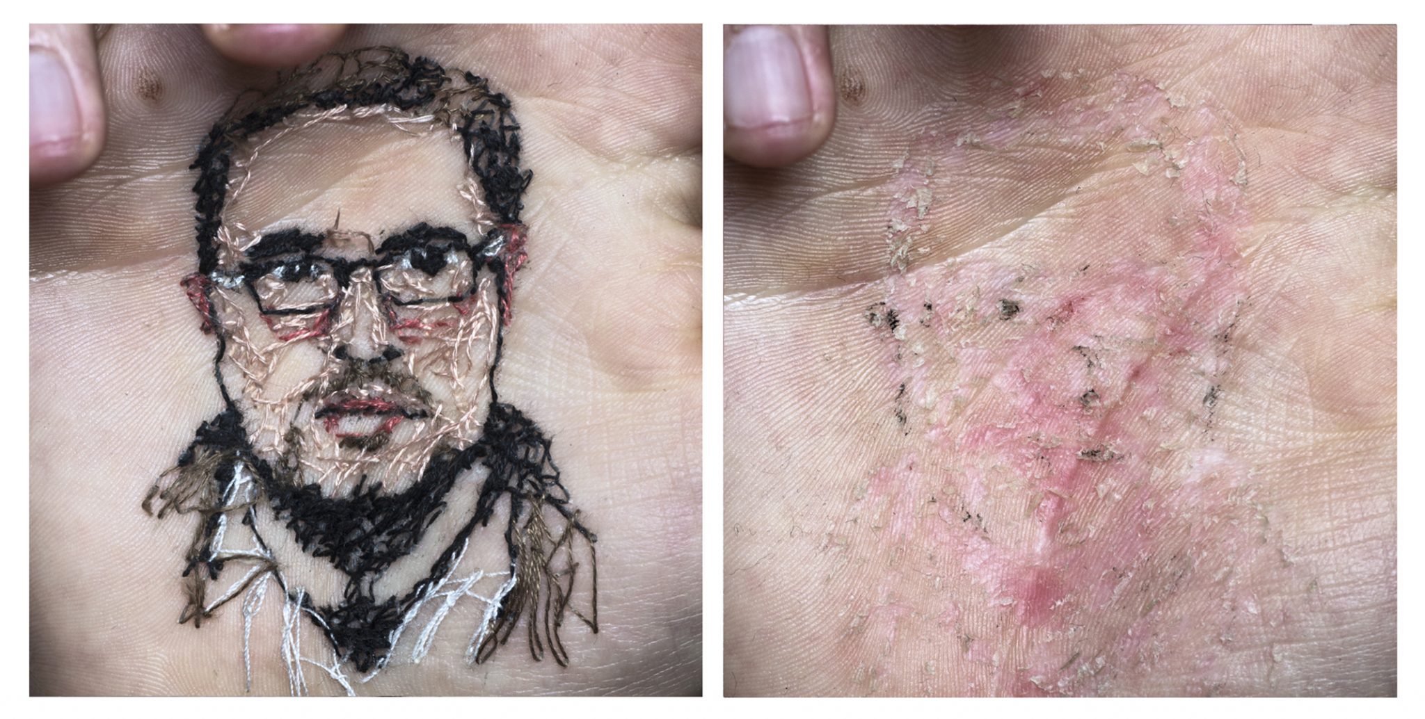 Mi amigo Carlos. A flor de piel, 16.