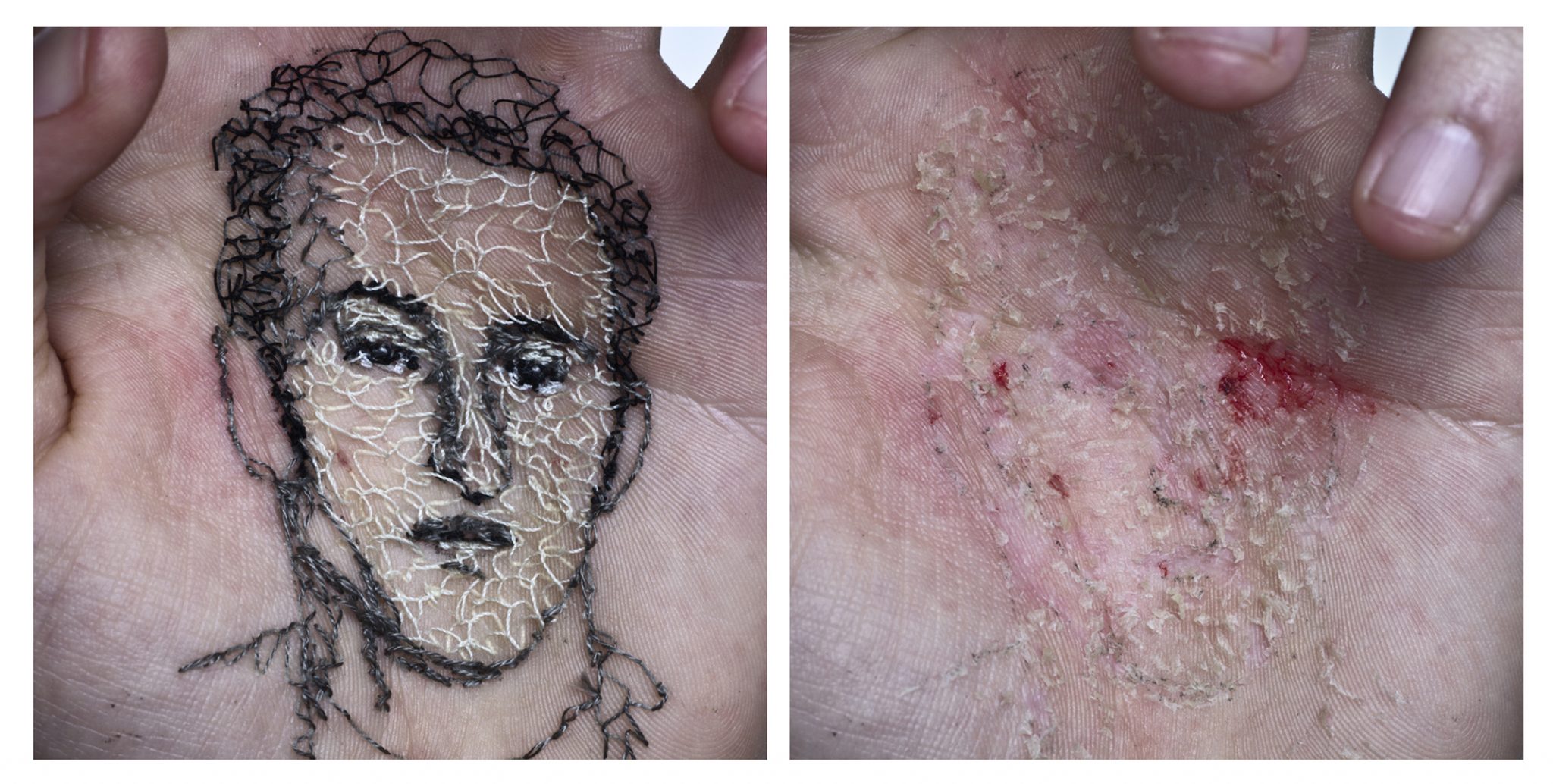 Abuelo Raimundo. A flor de piel, 08.